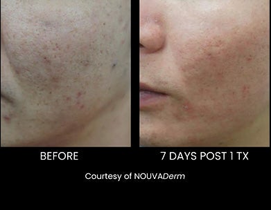 Luna Soleil Med Spa in PA