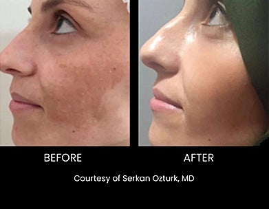 Luna Soleil Med Spa in PA